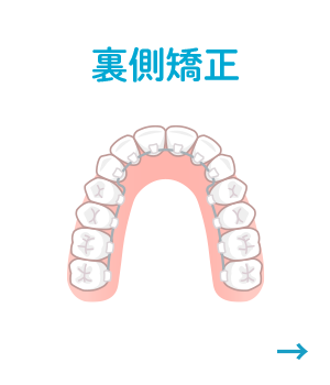 裏側矯正